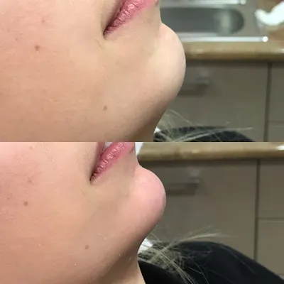 Medycyna Estetyczna Szczecin dr Filip Jeziorowski